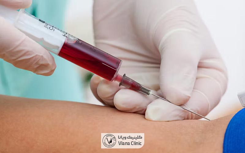 آزمایش عملکرد کلیه قبل از عمل بینی یکی از آزمایشات مهم است
