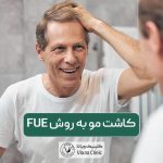 کاشت مو به روش FUE چگونه انجام میشود؟ مزایا، هزینه و مراحل آن