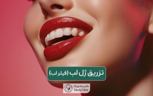 تزریق ژل لب و فیلر لب در یکی بهترین کلینیک های زیبایی تهران و عوارض آن