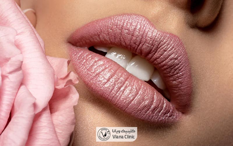 فیلر و ژل لب چگونه تزریق میشود؟ 4 مرحله تزریق فیلر لب