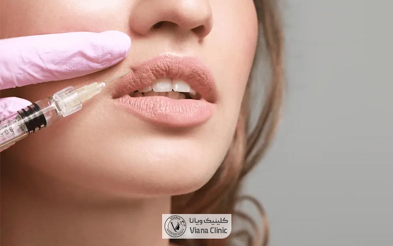 حساسیت و ایجاد واکنش های آلرژیک یکی از عوارض ژل و فیلر لب است