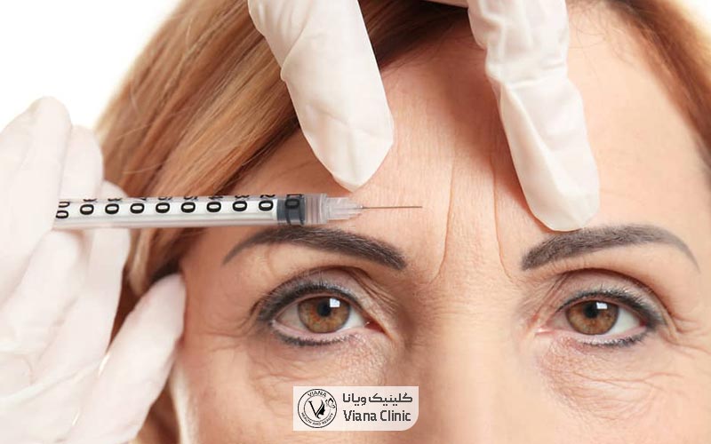 تزریق بوتاکس نیز یکی از انواع روش‌های تزریق جهت جوانسازی پوست و صورت است