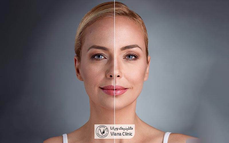 تزریق چربی راهی برای جوانسازی
