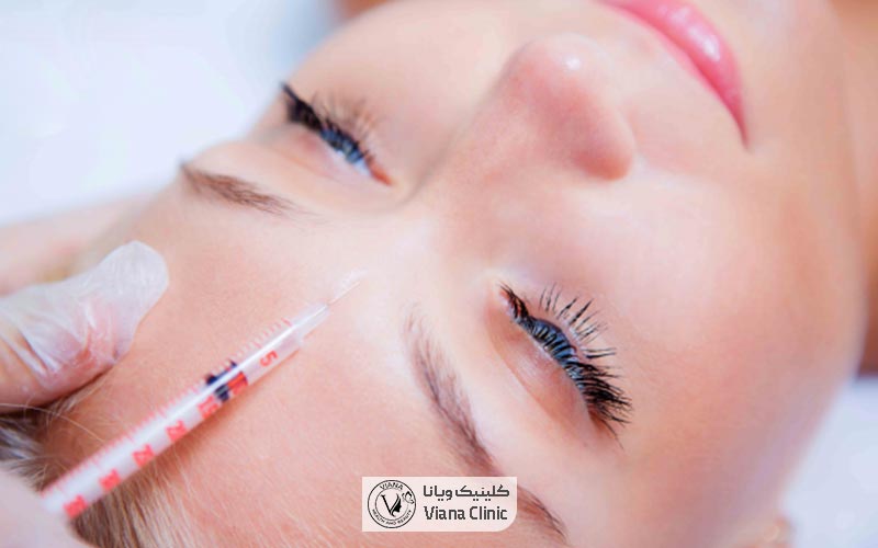 مراحل تزریق ژل و فیلر به همراه نحوه انجام آن