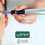 مزوتراپی چیست و چگونه انجام می‌شود؟ انواع مزوتراپی جهت جوانسازی پوست