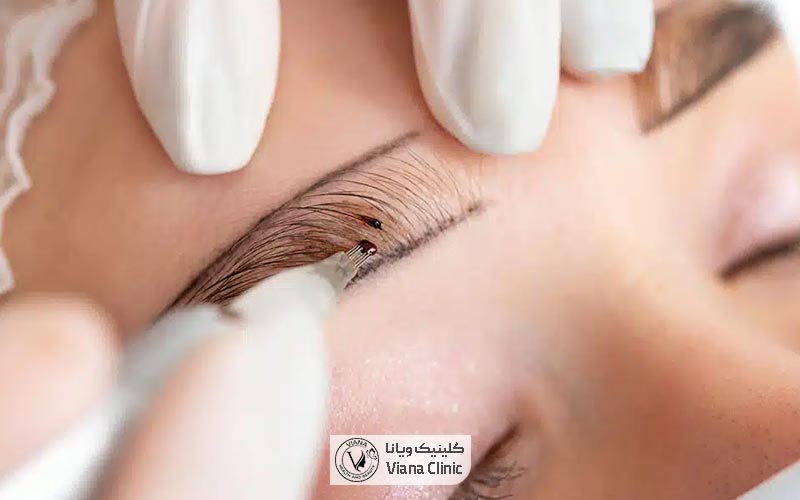 میکرو بلیدینگ ابرو (میکرو ابرو) چیست و چه کاربردی دارد