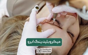 میکروبلیدینگ ابرو چیست؟ فرق و تفاوت کاشت ابرو با میکرو ابرو