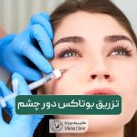تزریق بوتاکس دور چشم چگونه انجام می شود؟ مزایا و عوارض بوتاکس زیر چشم