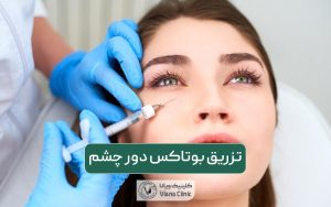 تزریق بوتاکس دور چشم چگونه انجام می شود؟ مزایا و عوارض بوتاکس زیر چشم