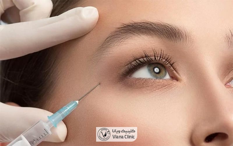 تزریق بوتاکس دور چشم و زیر چشم چیست و چه کاربردی دارد