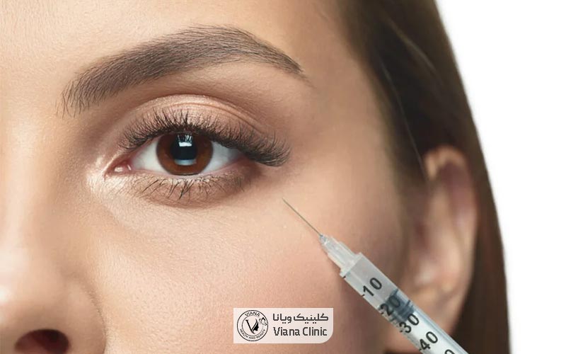 مزایای تزریق بوتاکس زیر چشم چه مواردی است