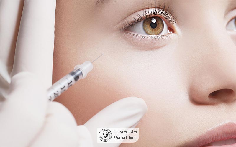 راه های پیشگیری از عوارض بوتاکس دور چشم