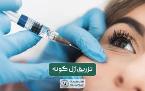 تزریق ژل گونه و مراحل انجام آن به همراه مزایا و عوارش فیلر گونه
