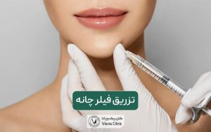 تزریق ژل چانه به همراه ماندگاری، عوارض و هزینه تزریق فیلر چانه و چونه در سال 1404