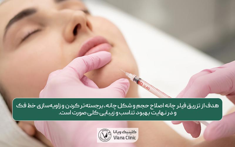 هدفاز تزریق فیلر و ژل چانه چیست
