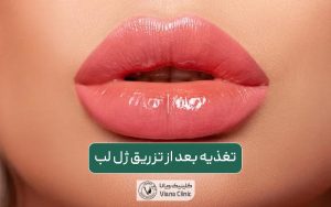 غذا خوردن بعد از تزریق ژل لب و نکات مهم مراقبتی بعد از آن