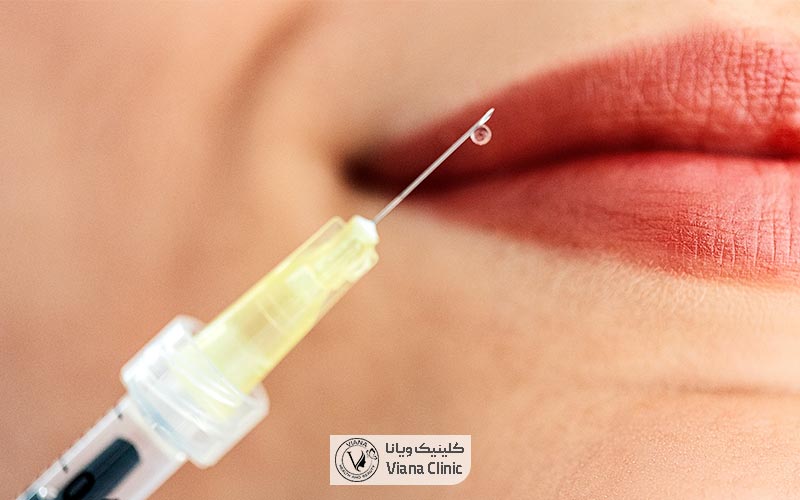 اهمیت تغذیه بعد از تزریق ژل و فیلر لب