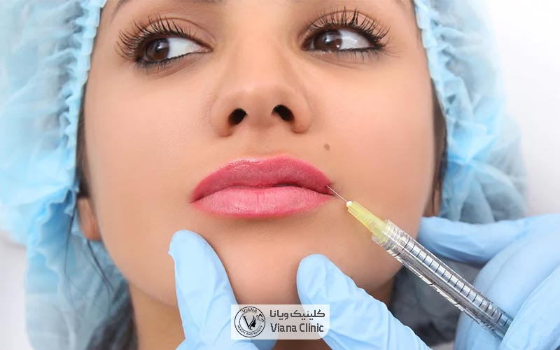 بعد از تزریق ژل لب چی بخوریم و چه نکاتی را رعایت کنیم