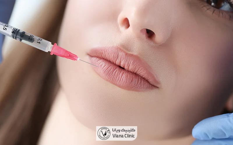 نکات مهم مراقبتی بعد از تزریق ژل لب