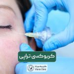 کربوکسی تراپی چیست؟ کاربرد و انواع روش های تزریق کربوکسی تراپی