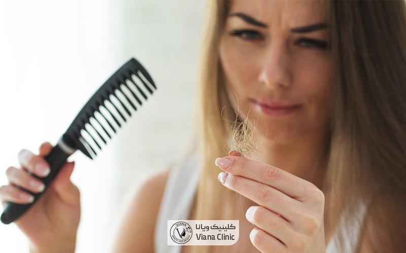 مشکلات تیروئید یکی از عوامل ریزش مو در مردان و زنان است