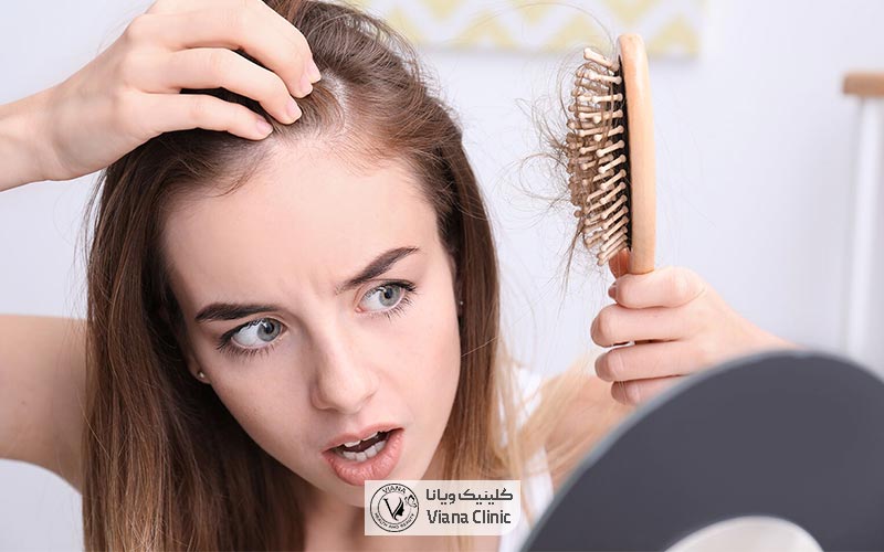 علت ریزش شدید موی سر در زنان چیست