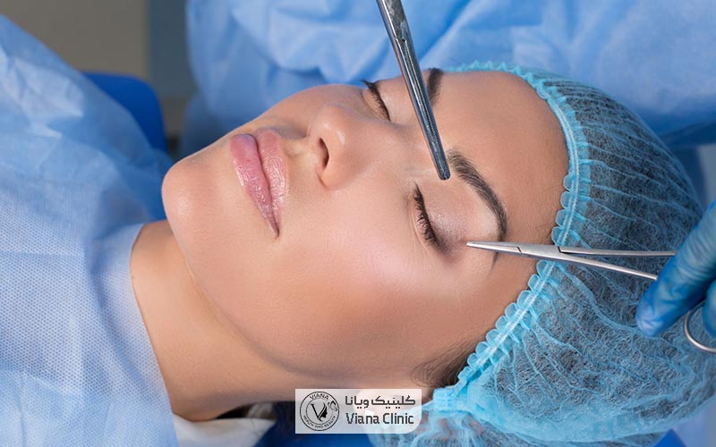 آیا بیمه قیمت روش های مختلف لیفت ابرو را تحت پوشش قرار می‌دهد و پرداخت میکند؟