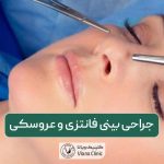 جراحی بینی فانتزی و انواع عمل بینی عروسکی زنانه و مردانه