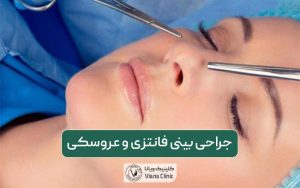 جراحی بینی فانتزی و انواع عمل بینی عروسکی زنانه و مردانه