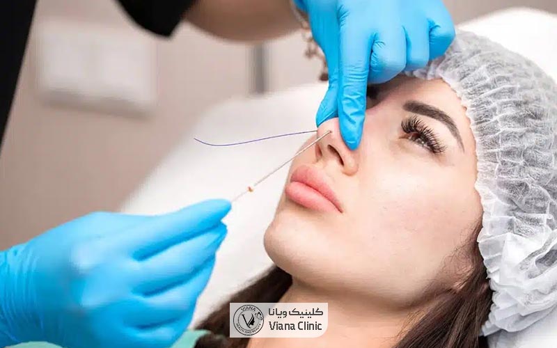 مراحل عمل بینی فانتزی و عروسکی چگونه است؟