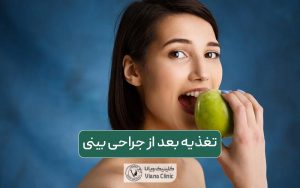 علت اهمیت تغذیه بعد از جراحی بینی چیست و چی باید بخوریم